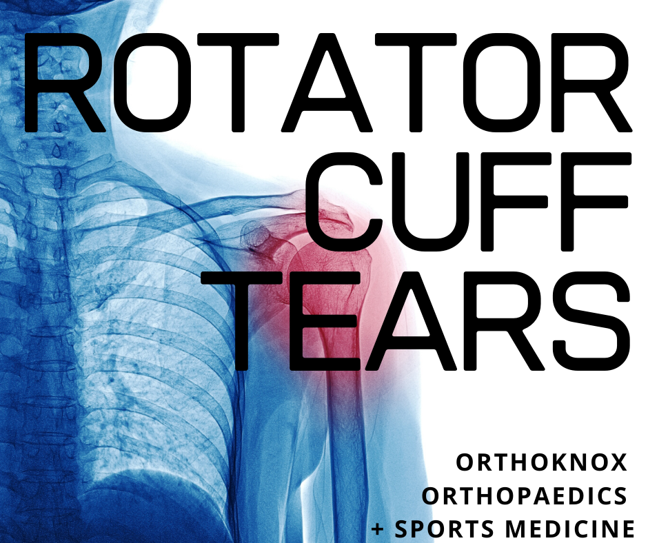 Shoulder Rotator Cuff Tears and Treatments
