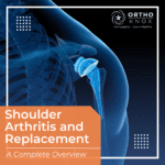 x ray of shoulder arthritis